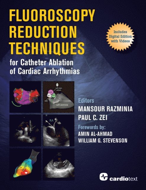 Paul C. Zei, Mansour Razminia - Fluoroscopy Reduction Techniques for Catheter Ablation of Cardiac Arrhythmias, E-bok