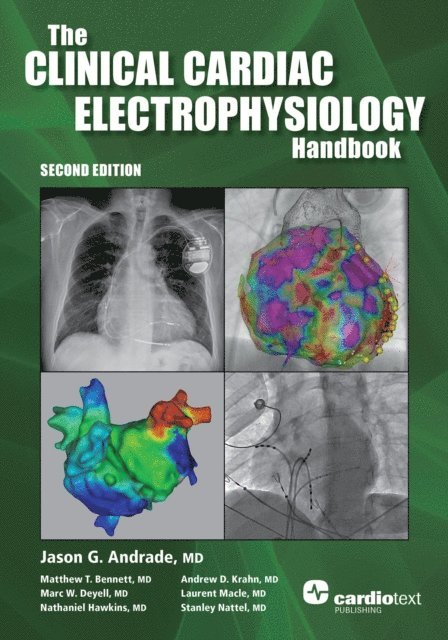 Jason Andrade - Clinical Cardiac Electrophysiology Handbook, Second Edition, E-bok