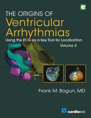 Frank M. Bogun - Origins of Ventricular Arrhythmias, Volume 2, Häftad