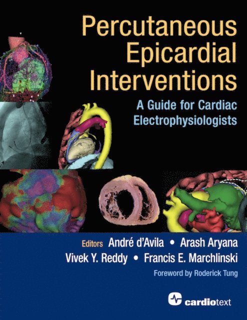 Vivek Y. Reddy, Arash Aryana, Andre d'Avila, Francis E. Marchlinski - Percutaneous Epicardial Interventions, E-bok