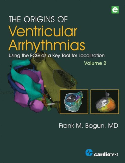 Frank M. Bogun - Origins of Ventricular Arrhythmias, Volume 2, E-bok