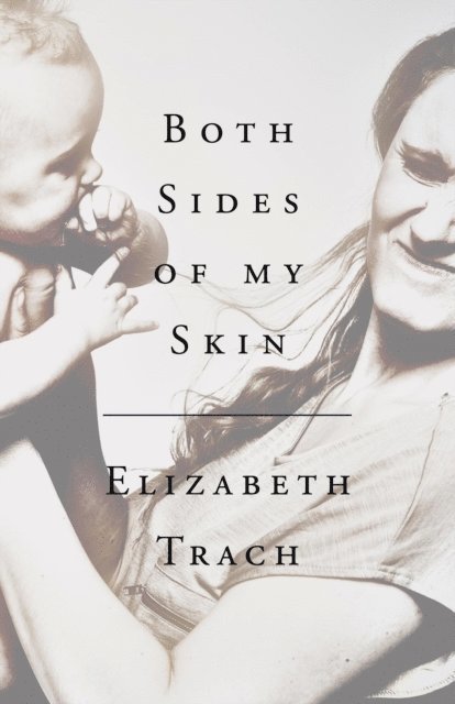 Elizabeth Trach - Both Sides of My Skin, E-bok