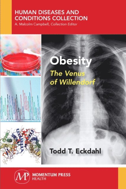 Todd T. Eckdahl - Obesity, E-bok
