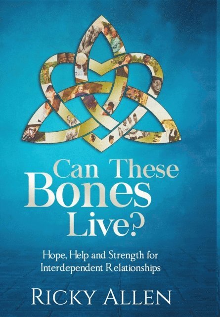 Ricky Allen, Ingrid Zacharias - Can These Bones Live?, E-bok