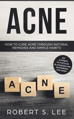 Robert S Lee - Acne, Häftad. Tillgänglighet: Lägg i varukorg