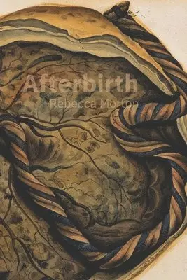 Rebecca Morton - Afterbirth, Häftad. Tillgänglighet: Lägg i varukorg