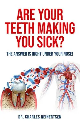 Charles W Reinertsen - Are Your Teeth Making You Sick?, Häftad. Tillgänglighet: Lägg i varukorg