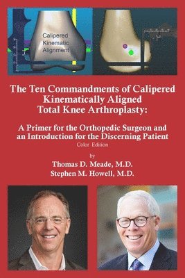 Thomas D Meade, Stephen M Howell - Ten Commandments of Calipered Kinematically Aligned Total Knee Arthroplasty, Häftad. Tillgänglighet: Lägg i varukorg