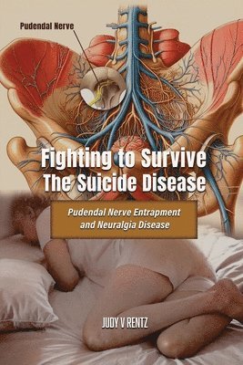 Judy V. Rentz - Fighting to Survive The Suicide Disease: Pudendal Nerve Entrapment and Neuralgia Disease, Häftad