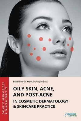 Elena Hernandez-Jimenez - Oily Skin, Acne, and Post-Acne in Cosmetic Dermatology & Skincare Practice, Häftad. Tillgänglighet: Lägg i varukorg