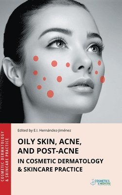 Elena Hernandez-Jimenez - Oily Skin, Acne, and Post-Acne in Cosmetic Dermatology & Skincare Practice, Inbunden. Tillgänglighet: Lägg i varukorg