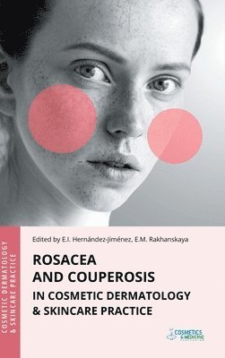 Elena Hernandez-Jimenez, Ekaterina Rakhanskaya - Rosacea and Couperosis in Cosmetic Dermatology & Skincare Practice, Inbunden. Tillgänglighet: Lägg i varukorg
