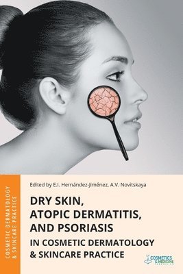 Elena Hernandez-Jimenez, Anastasia Novitskaya - Dry Skin, Atopic Dermatitis, and Psoriasis in Cosmetic Dermatology & Skincare Practice, Häftad. Tillgänglighet: Lägg i varukorg