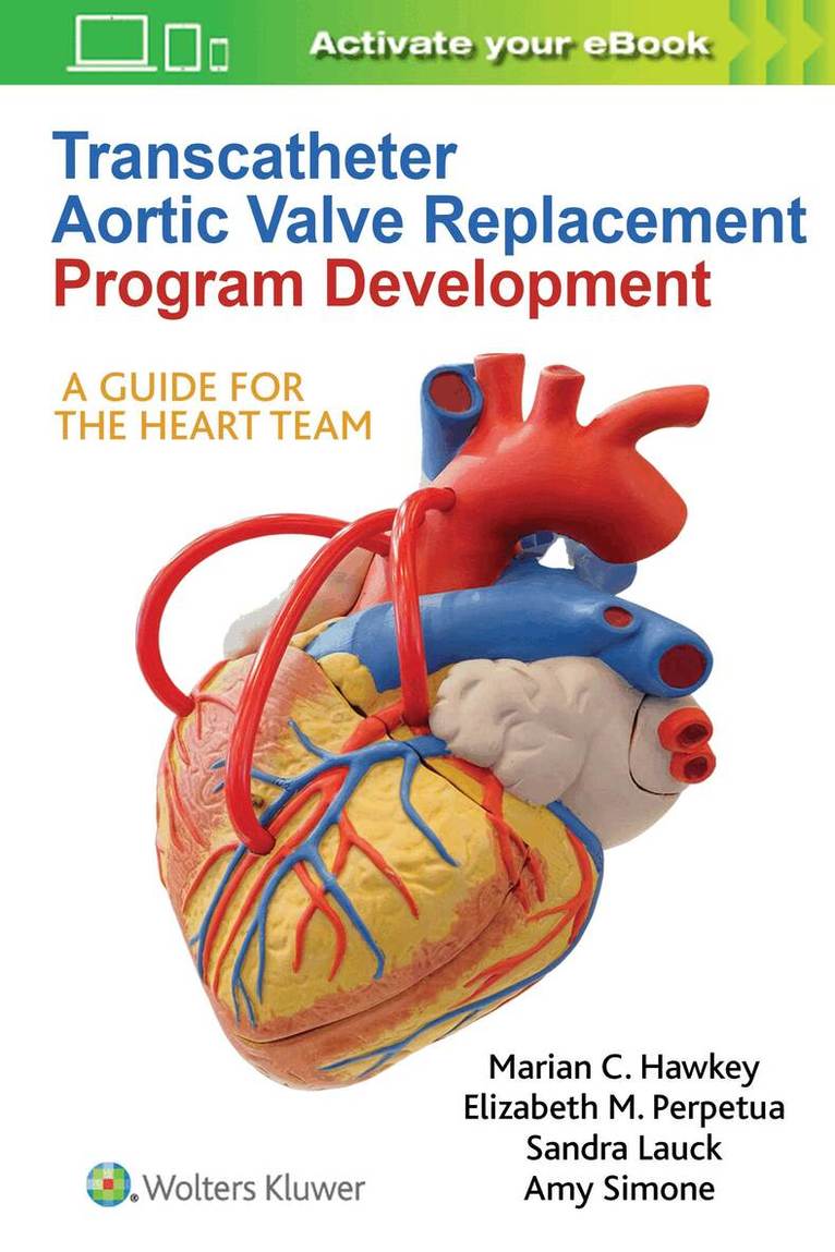 Marian C Hawkey, Sandra Lauck, Elizabeth M. Perpetua, Amy Simone - Transcatheter Aortic Valve Replacement Program Development, Häftad