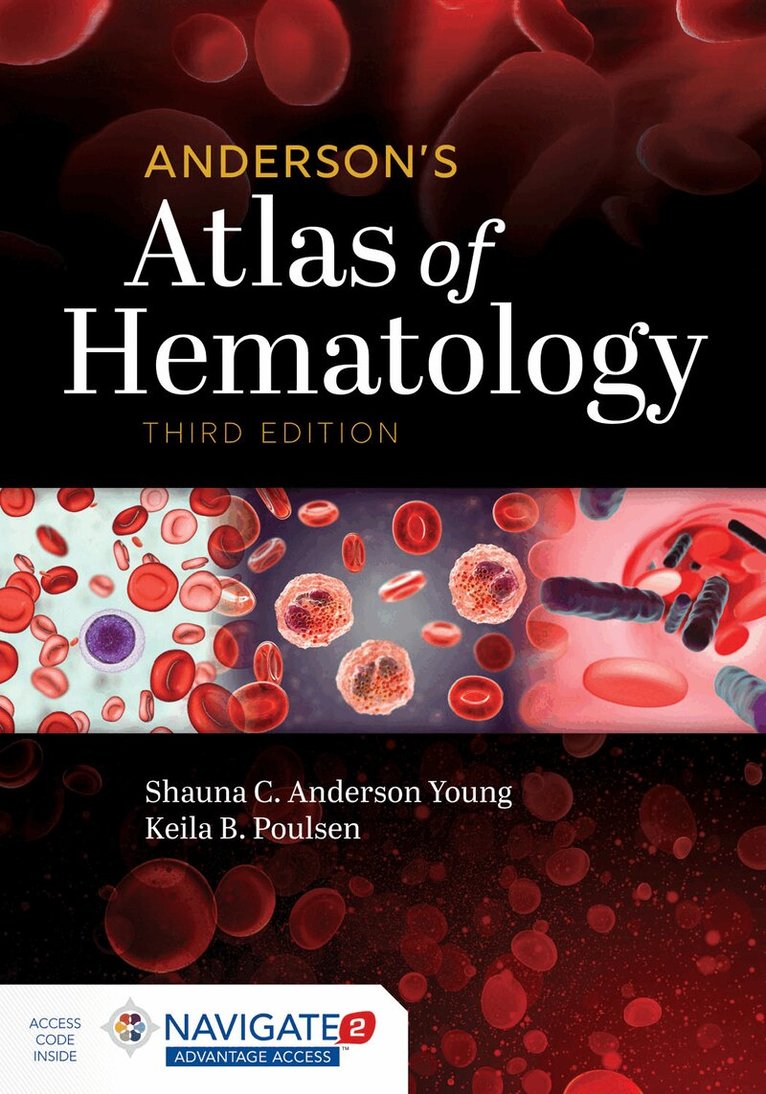 Shauna C. Anderson Young, Keila B. Poulsen - Anderson's Atlas of Hematology, Häftad