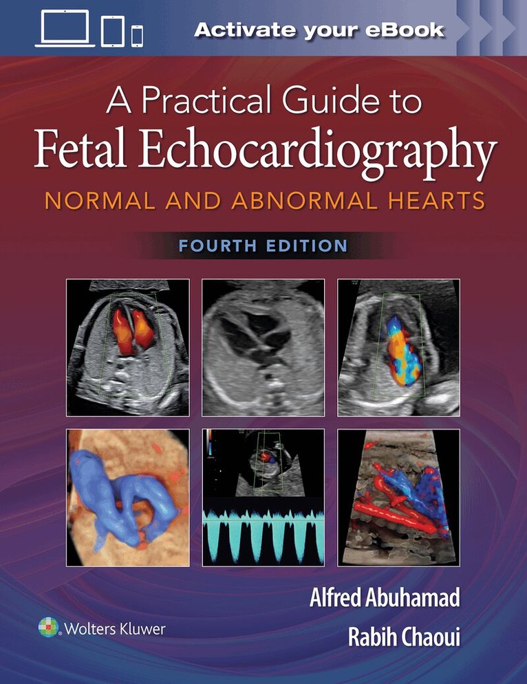 Alfred Z. Abuhamad, Rabih Chaoui - Practical Guide to Fetal Echocardiography, Inbunden