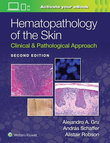Hematopathology of the Skin av Alejandro Ariel Gru, Andras Schaffer, Alistait Robson, Alistait Robson, Andras Schaffer