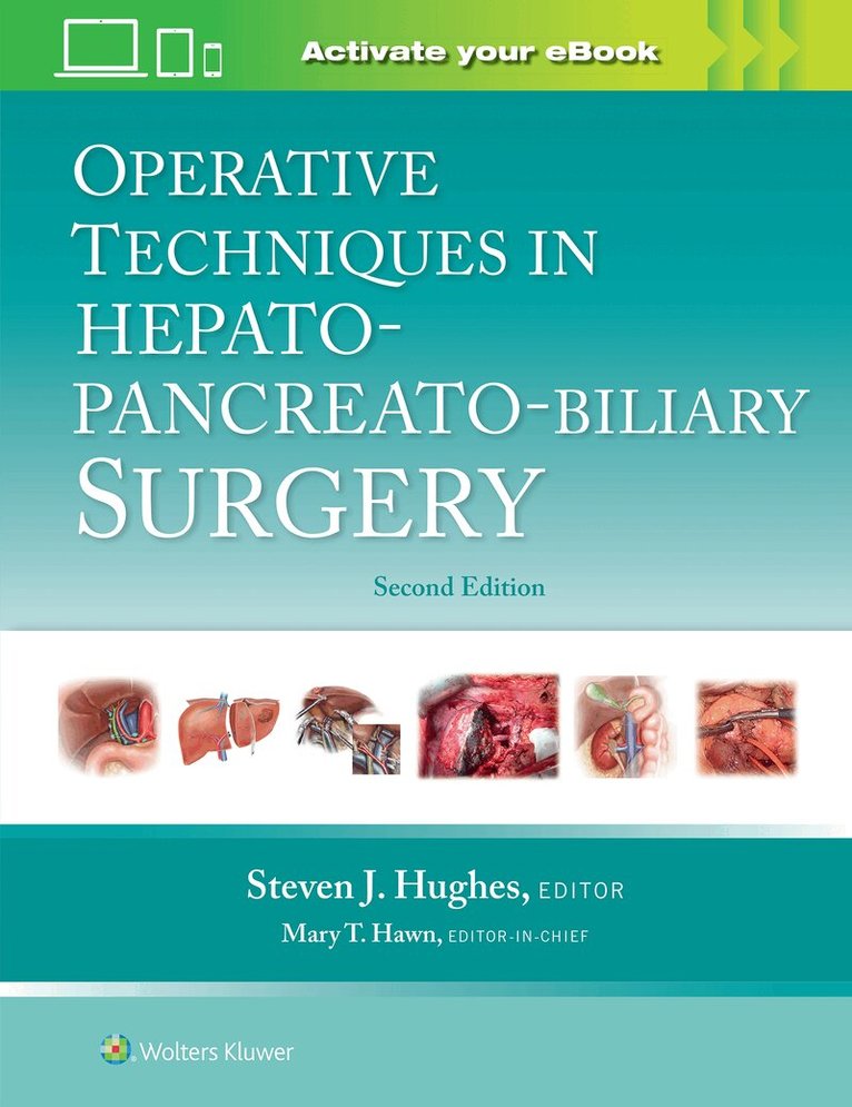 Steven J. Hughes - Operative Techniques in Hepato-Pancreato-Biliary Surgery: Print + eBook with Multimedia, Inbunden