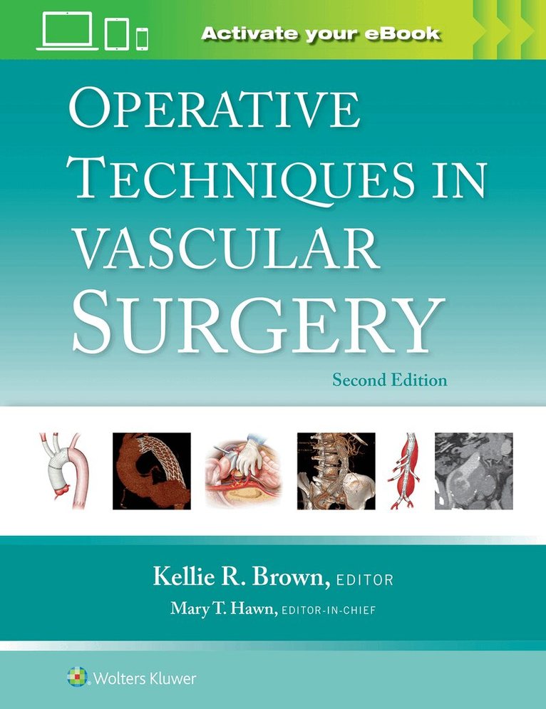 Kellie R. Brown - Operative Techniques in Vascular Surgery: Print + eBook with Multimedia, Inbunden