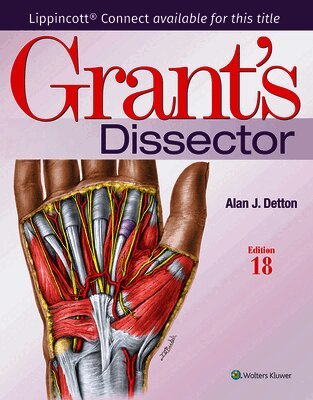 Alan Detton - Grant's Dissector, Övrigt