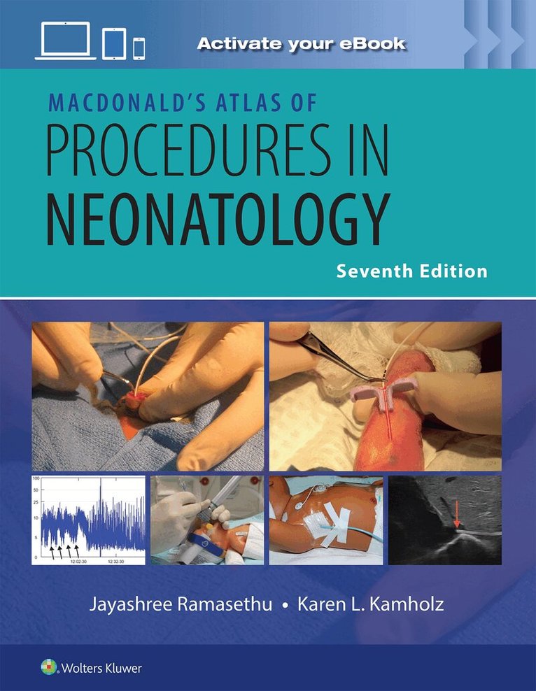 JAYASHREE RAMASETHU, SUNA SEO, Karen L. Kamholz - MacDonald’s Atlas of Procedures in Neonatology Print + eBook with Multimedia, Inbunden