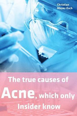 Christian Meyer-Esch - The true causes of Acne, which only Insider know, Häftad. Tillgänglighet: Lägg i varukorg