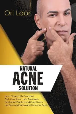 Ori Laor - Natural Acne Solution: How I Cleared My Acne and Post Acne Scars. Help Teenagers Treat Acne Problem and Cure Grown Ups from Adult Acne and Hormonal Ac, Häftad. Tillgänglighet: Lägg i varukorg
