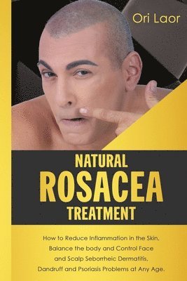 Ori Laor - Natural Rosacea Treatment: How to Reduce Inflammation in the Skin, Balance the body and Control Face and Scalp Seborrheic Dermatitis, Dandruff an, Häftad