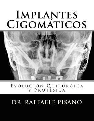 Raffaele Pisano - Implantes Cigomáticos: Evolución Quirúrgica y Protésica, Häftad. Tillgänglighet: Lägg i varukorg