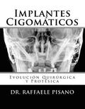 Implantes Cigomticos: Evolucin Quirrgica y Protsica