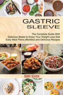 Terry Slater - Gastric Sleeve, Häftad. Tillgänglighet: Lägg i varukorg