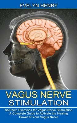 Vagus Nerve Stimulation