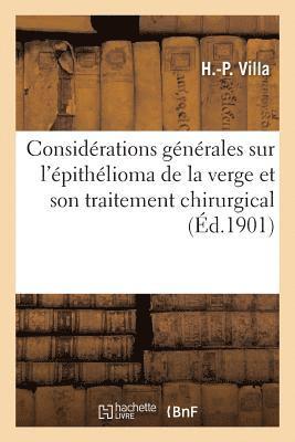 Villa - Considérations Générales Sur l'Épithélioma de la Verge Et Son Traitement Chirurgical, Häftad