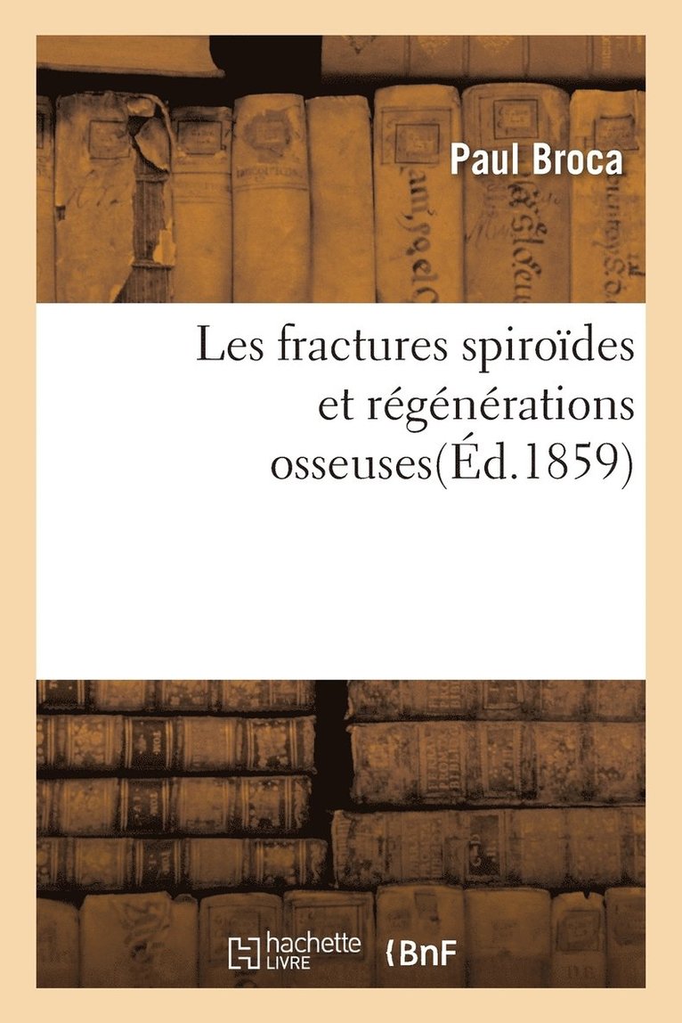 Paul Broca - Les Fractures Spiroïdes Et Régénérations Osseuses, Häftad. Tillgänglighet: Lägg i varukorg