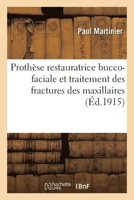 Paul Martinier - Prothèse Restauratrice Bucco-Faciale Et Traitement Des Fractures Des Maxillaires, Häftad. Tillgänglighet: Lägg i varukorg