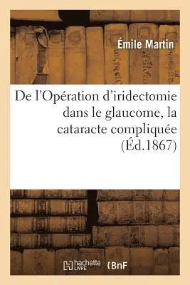 Émile Martin - De l'Opération d'iridectomie dans le glaucome, la cataracte compliquée, Häftad. Tillgänglighet: Lägg i varukorg