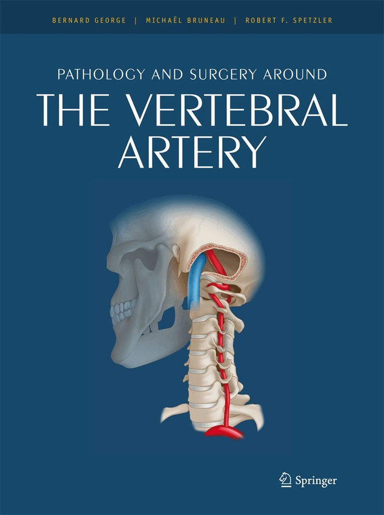 Bernard George, Michaël Bruneau - Pathology and surgery around the vertebral artery, Inbunden. Tillgänglighet: Lägg i varukorg