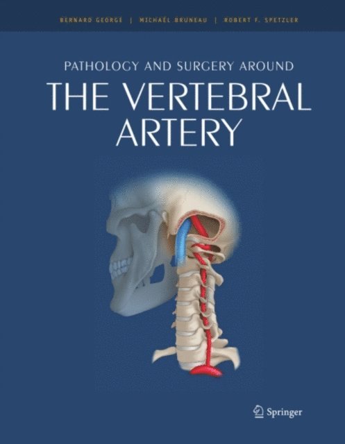 Michael Bruneau, Bernard George - Pathology and surgery around the vertebral artery, E-bok. Tillgänglighet: Lägg i varukorg