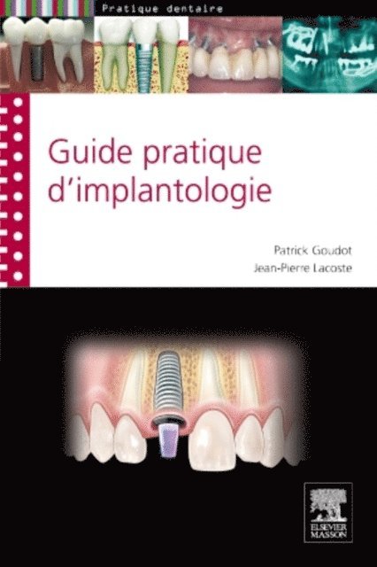 Jean-Pierre Lacoste - guide pratique d'implantologie, E-bok. Tillgänglighet: Lägg i varukorg