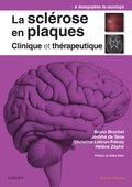 La sclÃ©rose en plaques - Clinique et thÃ©rapeutique