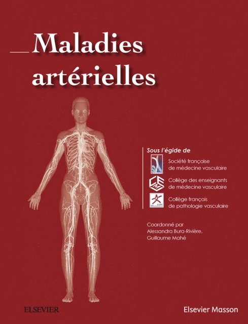 Societe Francaise de Medecine Vasculaire, Guillaume MAHE, College des enseignants de medecine vasc, College Francais de Pathologie Vasculair, Alessandra Bura-Riviere - Maladies arterielles, E-bok. Tillgänglighet: Lägg i varukorg