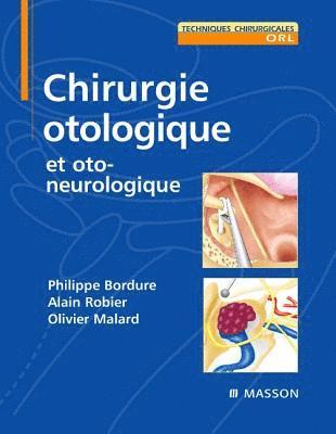 Chirurgie otologique