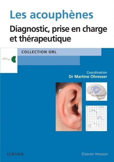Martine Ohresser - Les acouphenes, E-bok