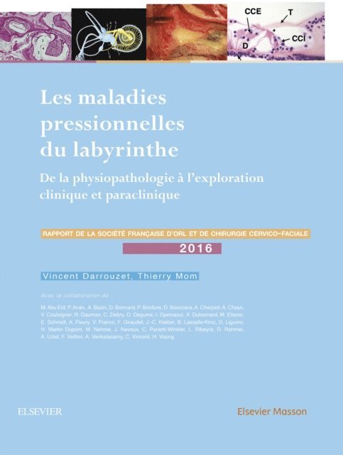 Thierry Mom, Vincent Darrouzet - Les maladies pressionnelles du labyrinthe, E-bok