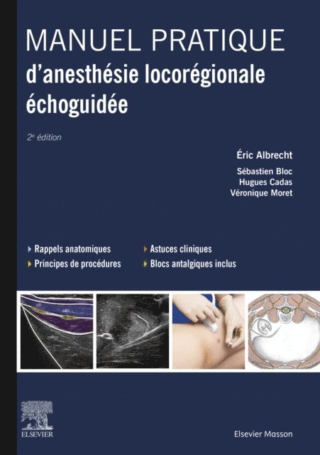 Veronique Moret, Hugues Cadas, Sebastien Bloc, Eric Albrecht - Manuel pratique d'anesthésie locorégionale échoguidée, E-bok