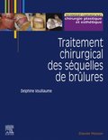 Traitement chirurgical des séquelles de brûlures
