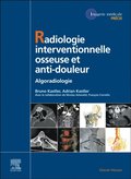 Radiologie Interventionnelle osseuse et anti-douleur
