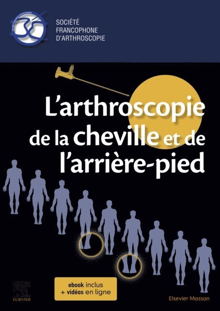 Ronny LOPES, Thomas Bauer, Societe Francophone D'Arthroscopie - L'arthroscopie de la cheville et de l'arriere-pied, E-bok