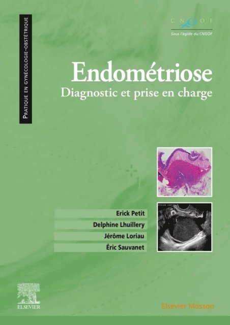 Eric Sauvanet, Jerome Loriau, Delphine Lhuillery, Erick Petit - Endométriose, E-bok. Tillgänglighet: Lägg i varukorg