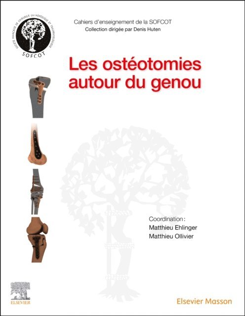 Jean-Noel Argenson, SOFCOT, Matthieu OLLIVIER, Matthieu Ehlinger - Les osteotomies autour du genou, E-bok